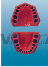 Standard gingival mucous membrane